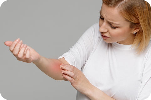 A woman scratching her atopic dermatitis on her arm